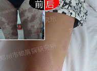 ˦����ţƤ������̸߿���