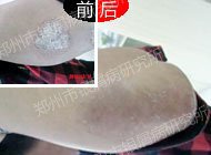 �����м����ӭ�������