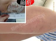 ��ȷ���ƣ���м����������