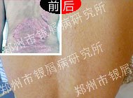 ���Ŷ������м���յ��Σ�