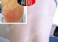 �����¸һ�����м����