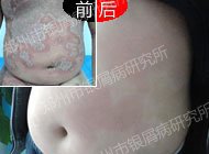 СС���꣬�¶���м��