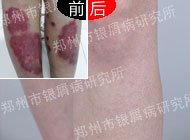 ˦����м�������򽡿�δ����