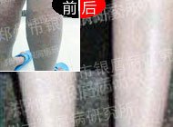 ����֮��,20�������һ������