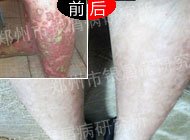 ����ȥ��������м��֮ʹ