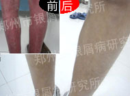 �κùؽڲ�����м������������������