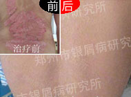 ��ʮ��շת��ҽ·  ���Ŷ�����м���յÿ���