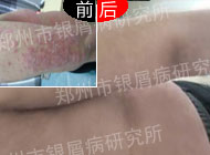 ���ȷ��֣������������������м��